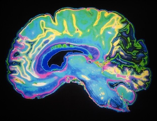 1753135816 Artificially Colored MRI Scan Of Human Brain Daisy Daisy a8c5d8bbbf824bc8932308e30187510f