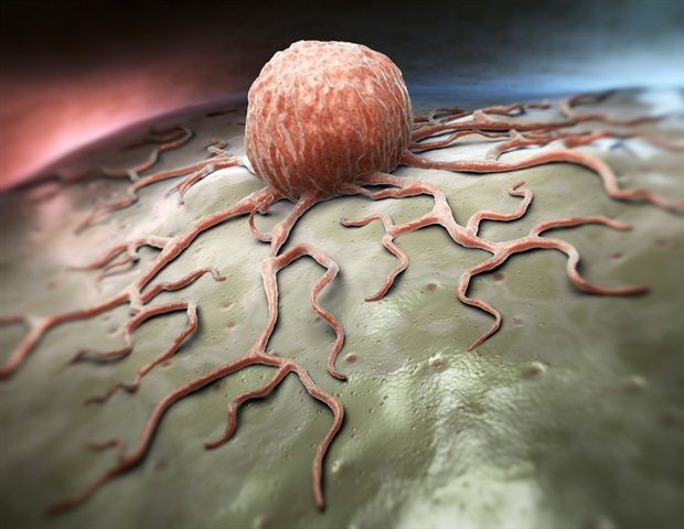 1753390695 Tumor 3b927f3db0dd47538f7791b7e005ae6a
