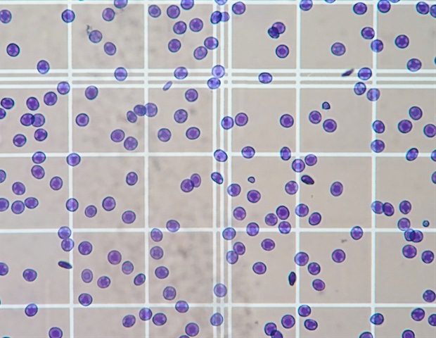 Blood cells on the scale counting chamber Choksawatdikorn cccc54fc703d4dd2bd6c77bd7840f594