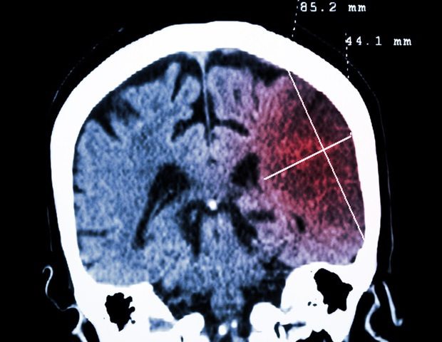 Collection of brain disease Puwadol Jaturawutthichai 1 f5c3d6d207b54f7ba8c652d29e186029